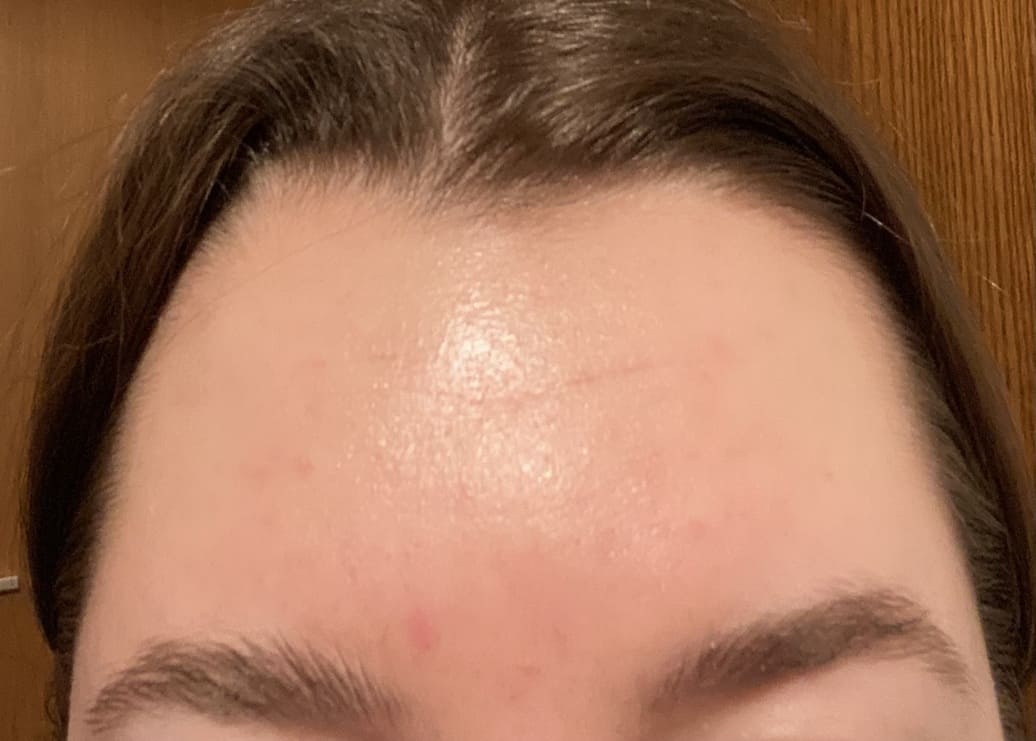 Nach 6 Monaten Image