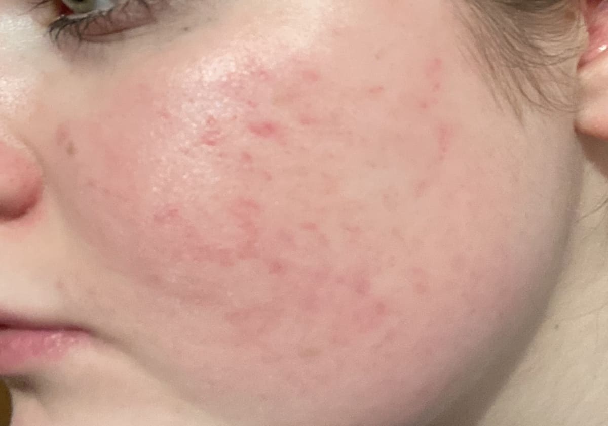 Nach 6 Monaten Image