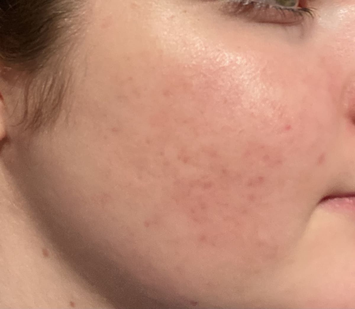 Nach 6 Monaten Image